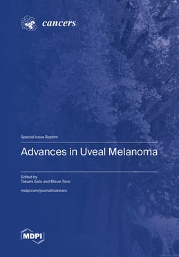 Advances in Uveal Melanoma