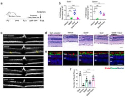 Effects of GALR3 antagonist, quercetin and their combination on the retinal morphology. (a) Schematic of experimental design, mouse treatment regimen and analysis. Mice were treated with GALR3 antagonist SNAP-37889, quercetin, or their combination starting at postnatal day 21 (P21) until P33 every other day followed by retinal analyses. (b) mRNA expression levels of Galr3 and spexin in retinas of rd10 normalized to their expression in WT mice detected with RT-qPCR. (c) Effects of treatments on retinal morphology examined by SD-OCT. Scale bar 100 µm. Arrows show the retina detachment. (d) Effects of treatments on retinal morphology examined by histological analysis. Scale bar 50 µm. (e) Immunohistochemistry analysis of rods and cone photoreceptors in retinal cryosections. Rods were labeled with a 1D4 anti-rhodopsin antibody (red) and cones with peanut agglutinin (PNA, green). ONL, outer nuclear layer; INL, inner nuclear layer; GCL, ganglion cell layer. (f) Quantification of the ONL thickness at 0.5 mm from the optic nerve head (ONH). Error bars represent standard deviation (S.D.). Statistically significant changes that were calculated with one-way ANOVA and Dunnett’s post hoc test are shown with asterisks. *, p < 0.05; **, p < 0.01; ***, p < 0.001; ****, p < 0.0001; ns, not statistically significant changes.