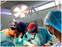 Head-mounted camera system in an intraoperative setting. Surgeons are equipped with wearable camera units positioned to capture the surgical field from a first-person perspective.