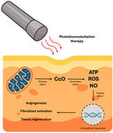 Simplified representation of the primary mechanisms of PBM. Light applied (red arrows) to the tissue is primarily absorbed by cytochrome c oxidase (CcO) in the mitochondria (primary effect), triggering the production of ATP, reactive oxygen species (ROS), and nitric oxide (NO) (secondary effect). These mediators lead to intracellular responses (tertiary effect) that promote key biological processes such as angiogenesis, fibroblast activation, and tissue regeneration.