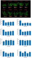 Root zone enzyme activity of oat under salt stress. Different lowercase letters denote significant differences between groups (p < 0.05). Q-0 h, Q-6 h, Q-12 h, Q-24 h, and Q-48 h indicate plants of saline–alkali-tolerant oat cv. Qinqiong under saline–alkali stress for 0, 6, 12, 24, and 48 h. M-0 h, M-6 h, M-12 h, M-24 h, and M-48 h indicate plants of saline–alkali-sensitive oat cv. Menglong under saline–alkali stress for 0, 6, 12, 24, and 48 h.
