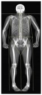The typical segmentation of the DXA body image for regional body composition analysis. The main regions are the head, left and right arms, the trunk, the pelvis, and the left and right legs.