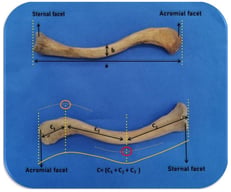 Anterior view of the clavicle (a) clavicle projection length (b) thickness at the narrowest part of the clavicle (c) true length of the clavicle, orange circle: midpoint of the acromioclavicular curvature, red circle: midpoint of the sternoclavicular curvature. c1: distance between the sternal articular surface and the midpoint of the sternoclavicular curvature, c2: distance between the midpoints of the sternoclavicular and the acromioclavicular curvatures, c3: distance between the midpoint of the acromioclavicular curvature and the acromial articular surface. The yellow line indicates the length of c and is shown in the figure.