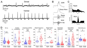 Baseline properties of SWRs and associated neuronal activity in dorsal and ventral hippocampus. (A) Representative extracellular field recordings from the CA1 stratum pyramidale illustrating spontaneous SWRs in dorsal (top) and ventral (bottom) hippocampal slices under control conditions. (B) Example of an individual SWR event. Top trace: raw signal (SWR). Middle traces: low-pass filtered signal (35 Hz) showing the sharp wave component and band-pass filtered signal (90–250 Hz) showing ripple oscillations. Bottom trace: band-pass filtered signal (0.4–1.5 kHz) revealing multiunit activity (MUA). Calibration bars: 50 μV, 10 ms. (C) Representative spectral and temporal characteristics of SWRs. Top: ripple power spectrum. Bottom: peri-event time histogram of MUA aligned to the SWR peak. (D) Quantification of SWR and MUA parameters in dorsal (blue) and ventral (red) hippocampus, including inter-event interval (IEI), probability of clustered events, sharp wave amplitude, ripple frequency, ripple power, baseline firing rate (MUA-Base), SWR-associated firing rate (MUA-SWR), and MUA delay relative to SWR peak (MUA-Delay). Numbers in parentheses in this and the following figures indicate the number of slices/rats. Significant differences between dorsal and ventral hippocampus are indicated (independent t-test, * p < 0.05, ** p < 0.01).