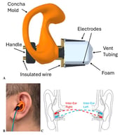 The SeizEAR device. (A): A three-dimensional diagram of the in-ear EEG design. (B): A SeizEAR device placed in an ear. (C): The conceptual design of cross-ear referencing.