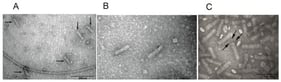 Electron micrographs of enterocoliticin particles from E. coli VCS257/Cos141 (A,B) and from Y. enterocolitica 29930 (C). The scale bar in (A) is 200 nm, and 100 nm in (B) and (C). The arrows in (A) indicate the enterocoliticin particles, and in (C), the tail fibers.