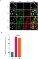 In situ hybridization chain reaction (HCR) and colocalization analysis of Bluetongue virus (BTV) in BSR cells. (A) BSR cells were infected with wild-type Bluetongue virus (BTV-WT) at a multiplicity of infection (MOI) of 100 for 8 h in 12-well plates, then fixed and incubated with probes targeting cellular mRNA or BTV +ssRNA segments for HCR and colocalization analysis. Uninfected BSR cells served as the mock control (row a). For the negative control (row b), cells were incubated with probes targeting cellular mRNA β-actin (ActB, green, Cy3, 550 nm) and BTV +ssRNA segment S10 (red, Cy5, 670 nm). The positive control (row c) utilized Cy3- and Cy5-labeled probes targeting different regions of segment S10 to validate colocalization and HCR. For (row d), probes labeled with Cy3 and Cy5 were used to target BTV RNA segments S6 and S10. Hoechst 33342 was used to stain cell nuclei. Colocalization analysis revealed yellow spots, indicating the overlap of Cy3 and Cy5 signals. (B) Pearson’s correlation coefficients were quantified to assess colocalization between Cy3 and Cy5 spots for each experiment. Analysis was conducted across five images from separate replicates, representing over 100 cells per experiment. The error bars represent standard deviations. Unpaired Student’s t-tests were performed to compare the colocalization analysis between each experiment group. ***: t-test p value < 0.005.