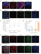 NMOs recapitulate neuromuscular architecture and support EV infection. (A) Representative immunofluorescence image of an IMR90-4-derived NMO stained for Hoechst, β-III-tubulin (TUJ1, neurons) and fast myosin heavy chain (Fast MyHC; muscle). Scale bars: 300 µm. (B) Confocal z-stack of a NMJ in an IMR90-4-derived NMO stained with Hoechst, α-bungarotoxin (α-BTX; nAChRs), β-III-tubulin (TUJ1), and Fast MyHC. The main panel shows the XY projection, with the orthogonal YZ view displayed on the bottom edge. Scale bars: 50 µm and 20 µm. (C) Relative increase in viral RNA copy numbers in the supernatant at indicated time points following infection with EV-A71 (0 vs. 24 hpi: p = 0.21; 0 vs. 48 hpi: *** p = 0.0003; 0 vs. 72 hpi: **** p < 0.0001) or EV-D68 (0 vs. 24 hpi: p = 0.16; 0 vs. 48 hpi: *** p = 0.0001; 0 vs. 72 hpi: **** p < 0.0001). Data represent the geometric mean of three technical replicates per condition, calculated separately for each hiPSC line: IMR90-4 (circles), Gibco® A18945 (squares), and M001 (triangles). Statistical significance was assessed per virus using a Kruskal–Wallis test with Dunn’s multiple comparisons test. (D) Viral titres of EV-A71 (* p < 0.05) and EV-D68 (p = 0.06) in the supernatant at 0 and 72 hpi. Data represent the geometric mean of three technical replicates per condition, calculated separately for each hiPSC line (IMR90-4 and M001). Statistical significance was assessed per virus using a Wilcoxon test. (E,F) Confocal z-stacks of Gibco® A18945-derived NMOs at 72 hpi infected with EV-D68 (E) or EV-A71 (F), stained for Hoechst, Fast MyHC, dsRNA, and β-III-tubulin (TUJ1). The main panels show XY projections, with orthogonal XZ and YZ views displayed on the left and bottom edges, respectively, to visualize the three-dimensional distribution of the signal. Scale bars: 50 µm.