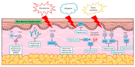 Schematic representation of key pathogenic pathways in atopic dermatitis. Environmental, microbiome and allergens, and genetic factors converge on epidermal barrier dysfunction, promoting type 2–skewed immunity (TSLP–Th2–IL-4/IL-13 axis, IgE production, eosinophilic inflammation) and downstream Th1/Th17/Th22 responses. Reprinted from Ref. [31]. Black arrows indicate pathway direction or activating interactions, while blunt-ended lines indicate inhibition.