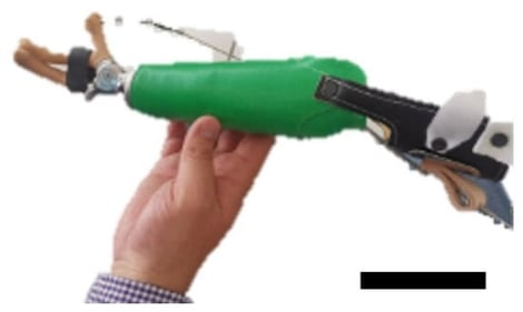 Harness and hook prosthesis for a pediatric patient (Scale Bar 10 cm).