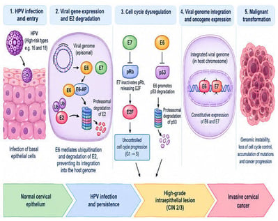 Simplified mechanistic model of HPV-driven cervical carcinogenesis. Persistent infection with high-risk HPV, particularly HPV16 and HPV18, facilitates viral genome integration into the host genome and sustained expression of the viral oncogenes E6 and E7. E6 recruits E6-associated protein (E6-AP), promoting ubiquitination and proteasomal degradation of the tumour suppressor p53, thereby impairing DNA-damage-induced cell-cycle arrest and apoptosis. E7 binds and functionally inactivates retinoblastoma protein (pRb), releasing E2F transcription factors and promoting unscheduled S-phase entry and cellular proliferation. Disruption of these tumour-suppressor pathways is accompanied by p16^INK4a^ accumulation, increased Ki-67 expression, genomic alterations, altered cellular metabolism, and progressive cervical dysplasia, ultimately contributing to invasive cervical cancer. This mechanistic sequence reflects the molecular processes described in the manuscript.
