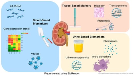 Current landscape of biomarkers: blood-based, urine-based and tissue-based tests. Blood-based biomarkers are minimally invasive and include dd-cfDNA, gene expression profiling and viruses. Tissue-based biomarkers measure sets of transcriptional signatures to define a disease phenotype. Urine-based biomarkers such as chemokines, cytokines, mRNA and urinary exosomal mRNA, can offer direct insight into the allograft microenvironment.