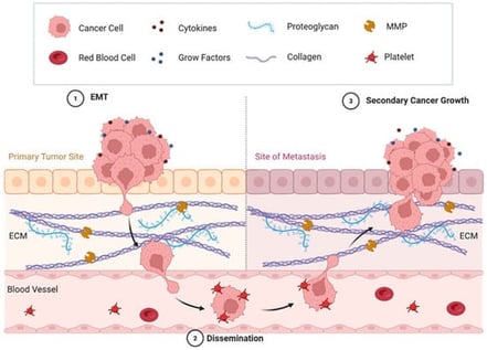 Stages of the metastatic process in cancer. The metastatic process occurs in three main phases: (1) EMT, which involves loss of cell adhesion and apicobasal polarity; in addition, tumor cells invade the extracellular matrix through the action of MMPs. (2) Dissemination, in which tumor cells intravasate into the bloodstream, interact with platelets for protection, and survive in circulation. (3) Secondary cancer growth, which involves extravasation into the extracellular matrix at a distant site and the formation of a new tumor. Figure created with BioRender.com.