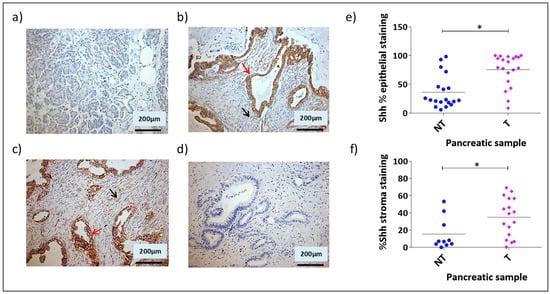 Cells 08 00424 g0a1 550