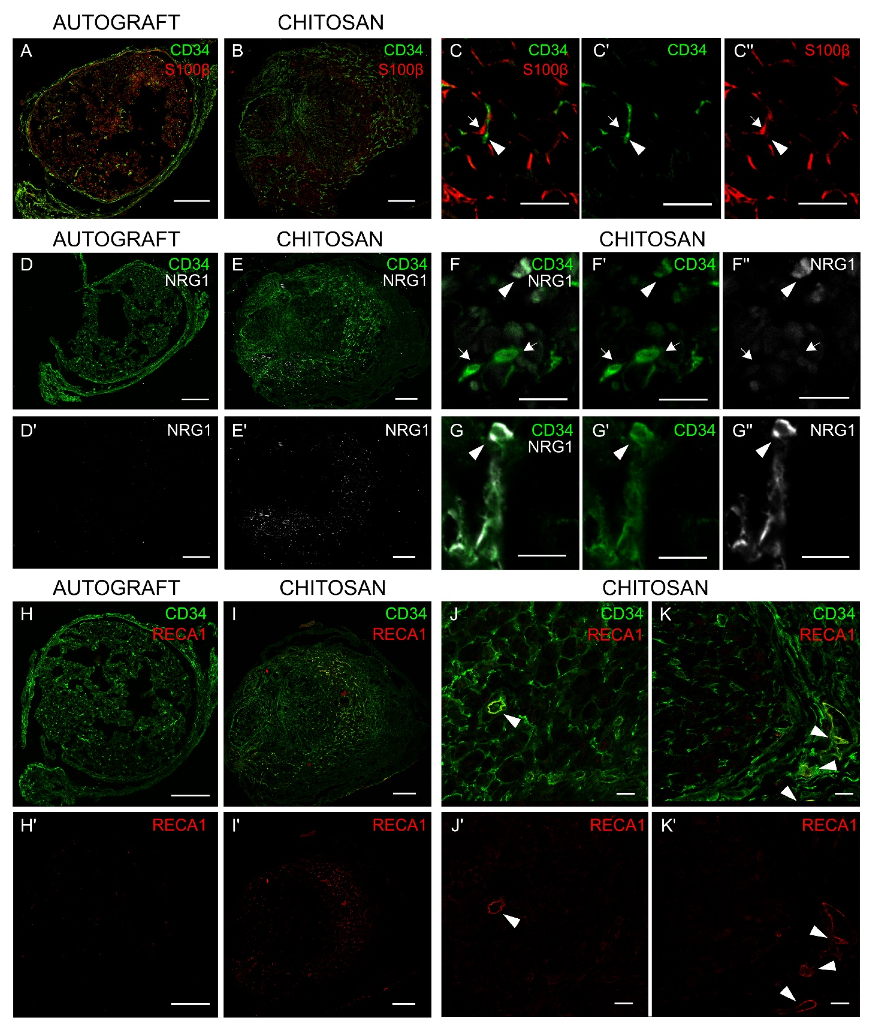 Cells 09 01366 g004