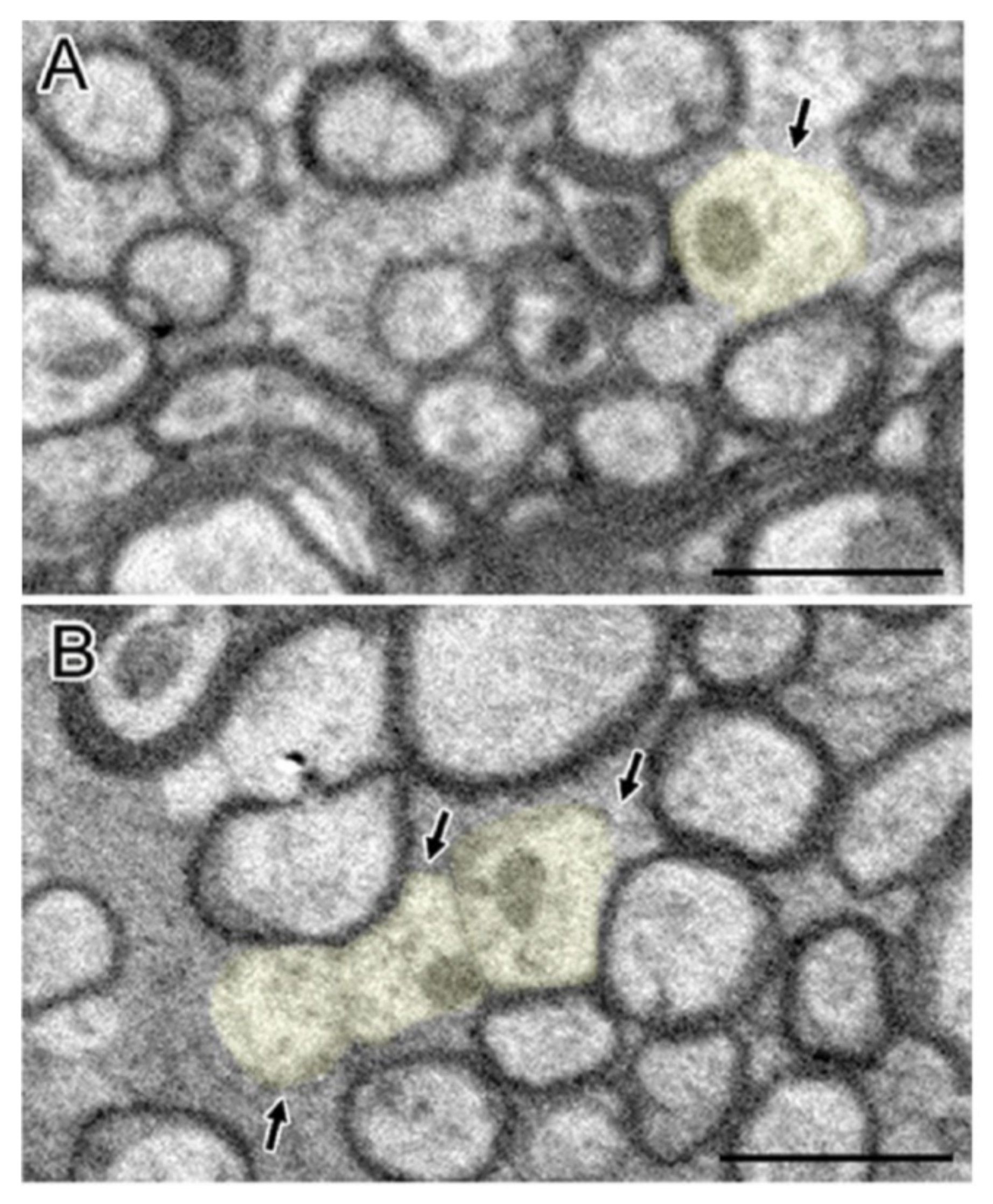 Cells 10 01009 g003 Cells 10 01009 g003