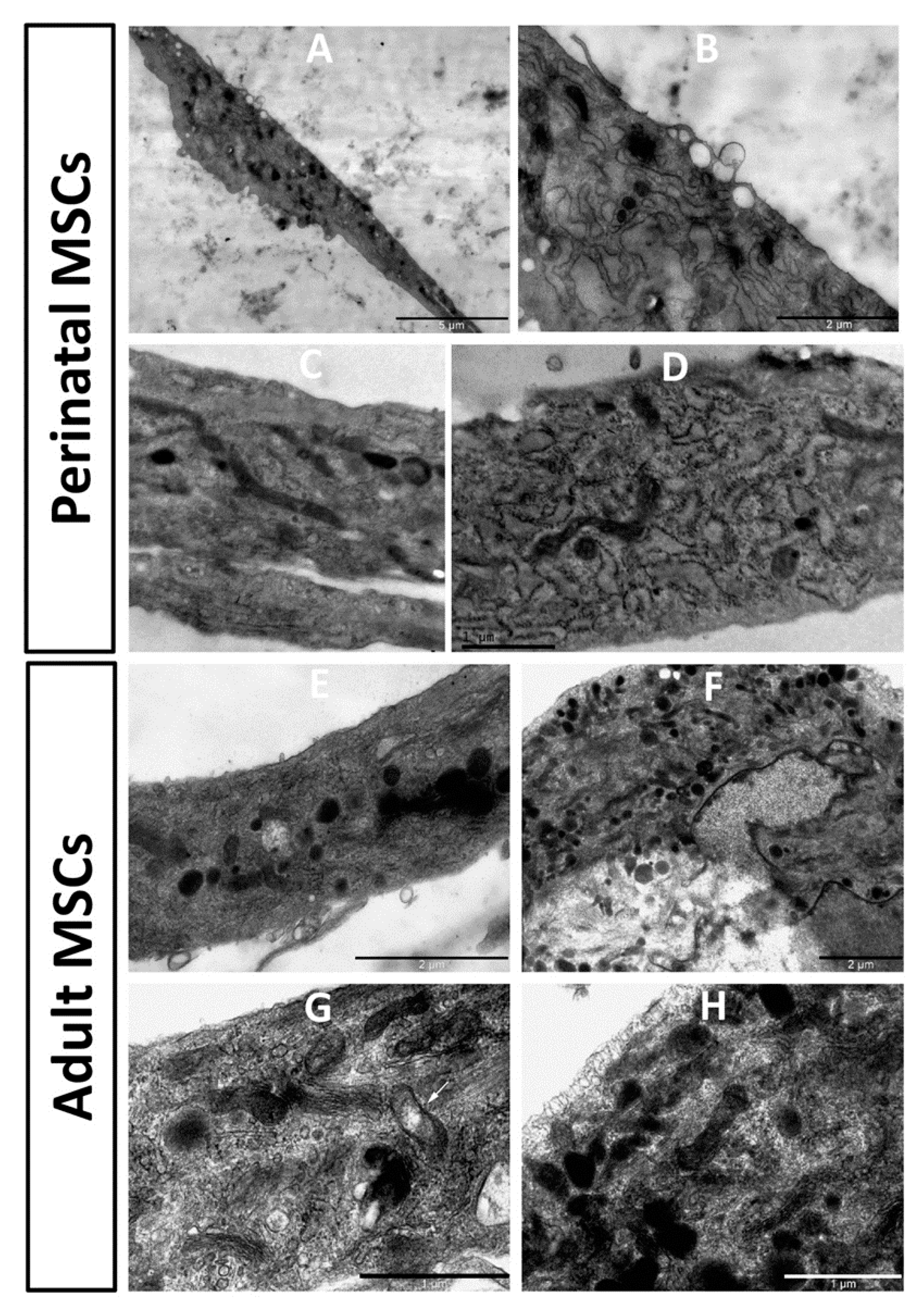 Cells 10 01273 g006 Cells 10 01273 g006
