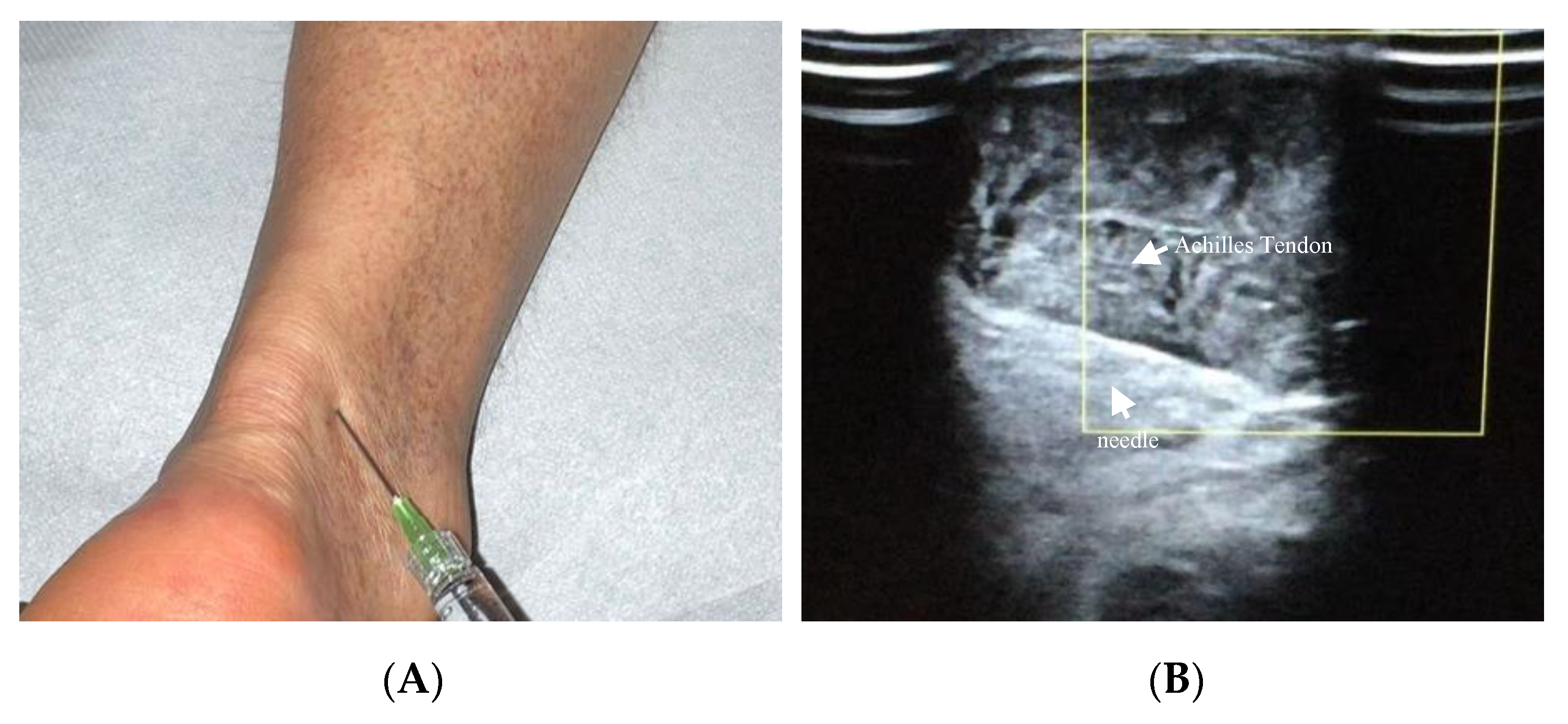 Cells 10 03081 g003 Cells 10 03081 g003