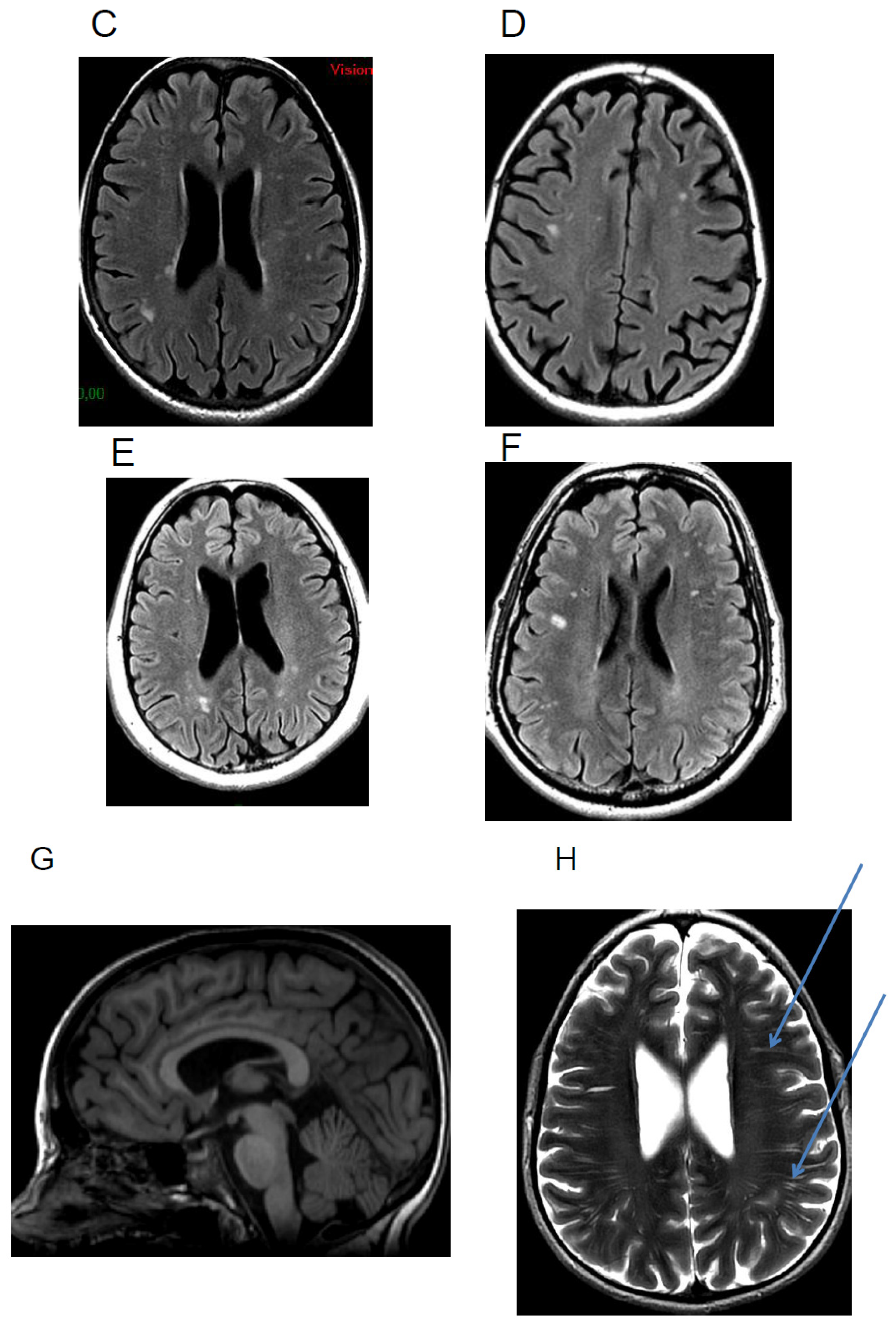 Cells 11 00682 g002b