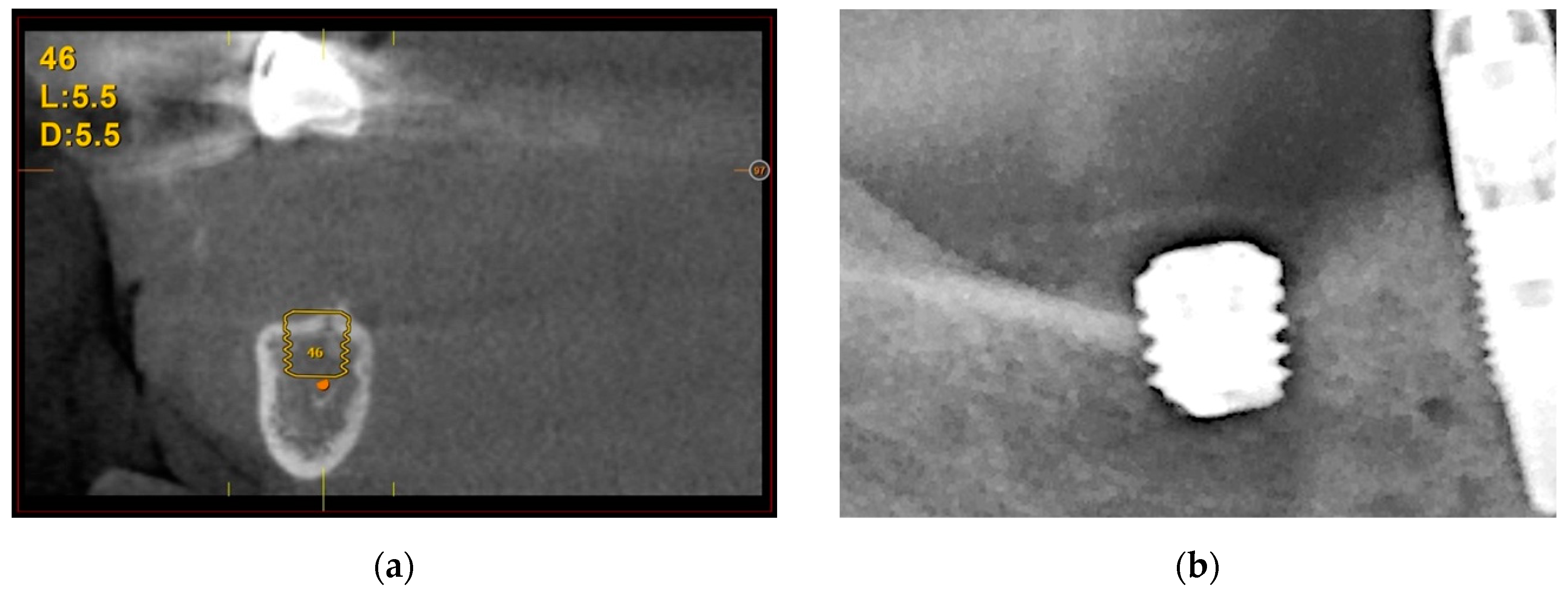 Cells 11 03048 g007a Cells 11 03048 g007a