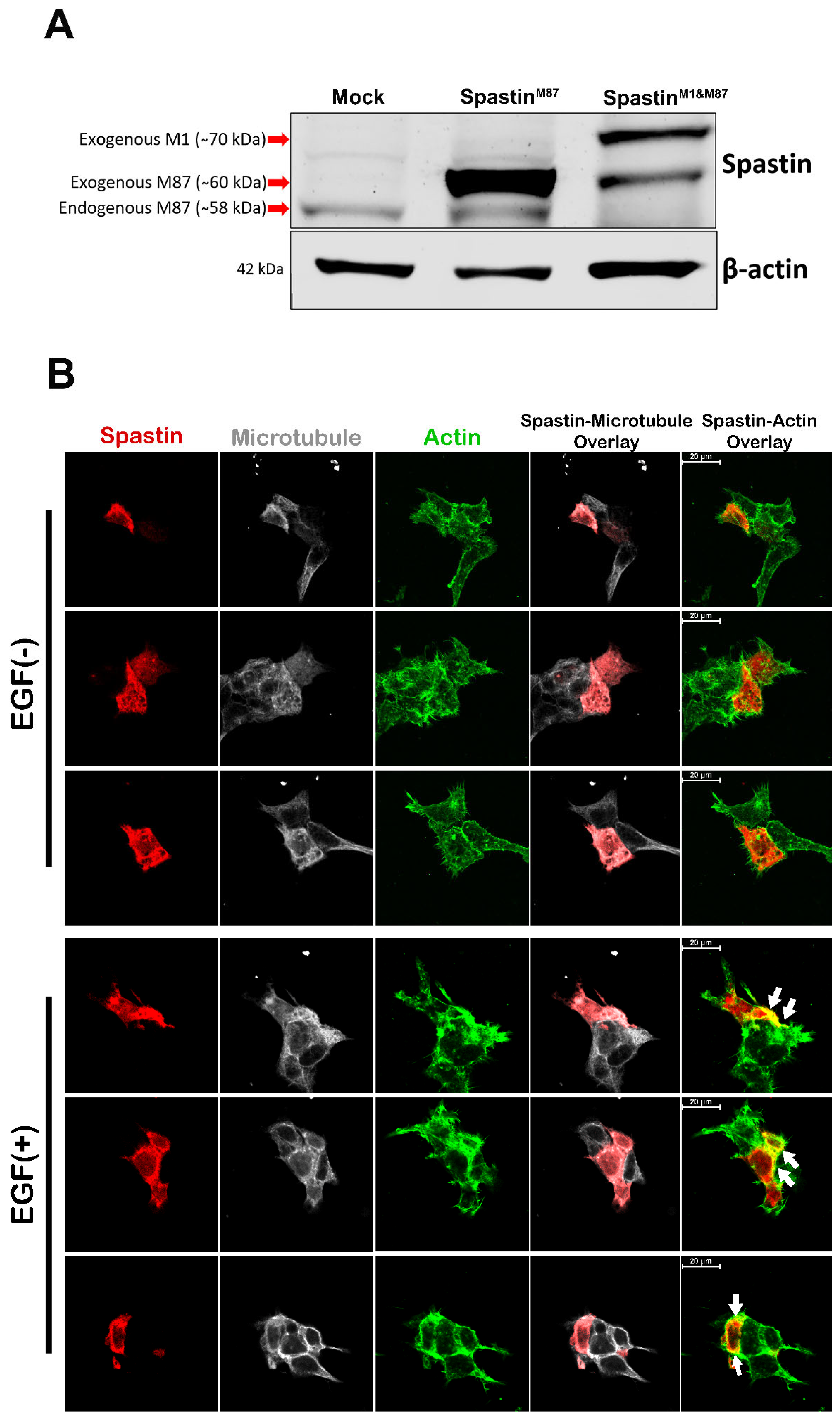 Cells 12 00427 g006a Cells 12 00427 g006a
