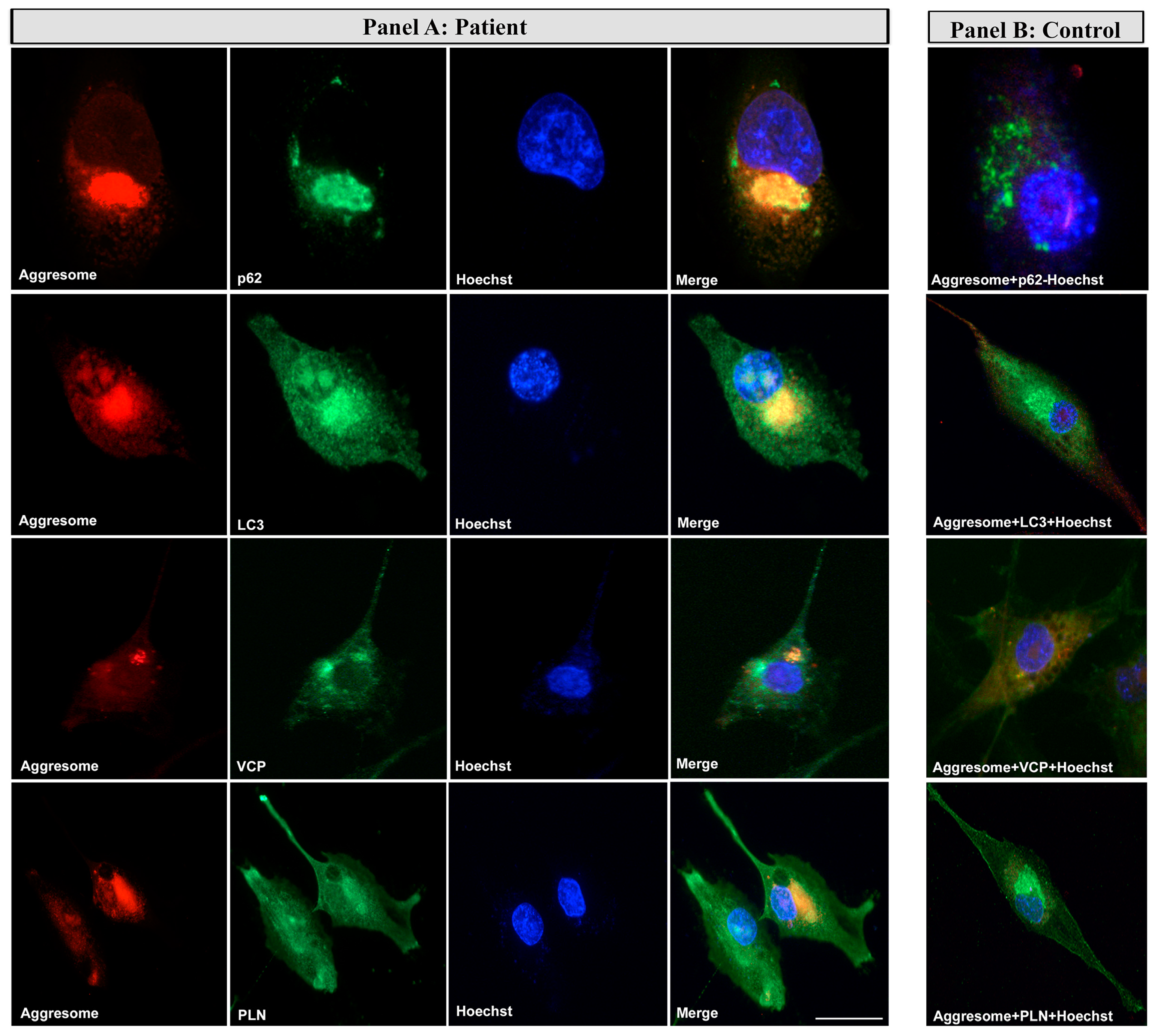 Cells 12 01405 g008 Cells 12 01405 g008