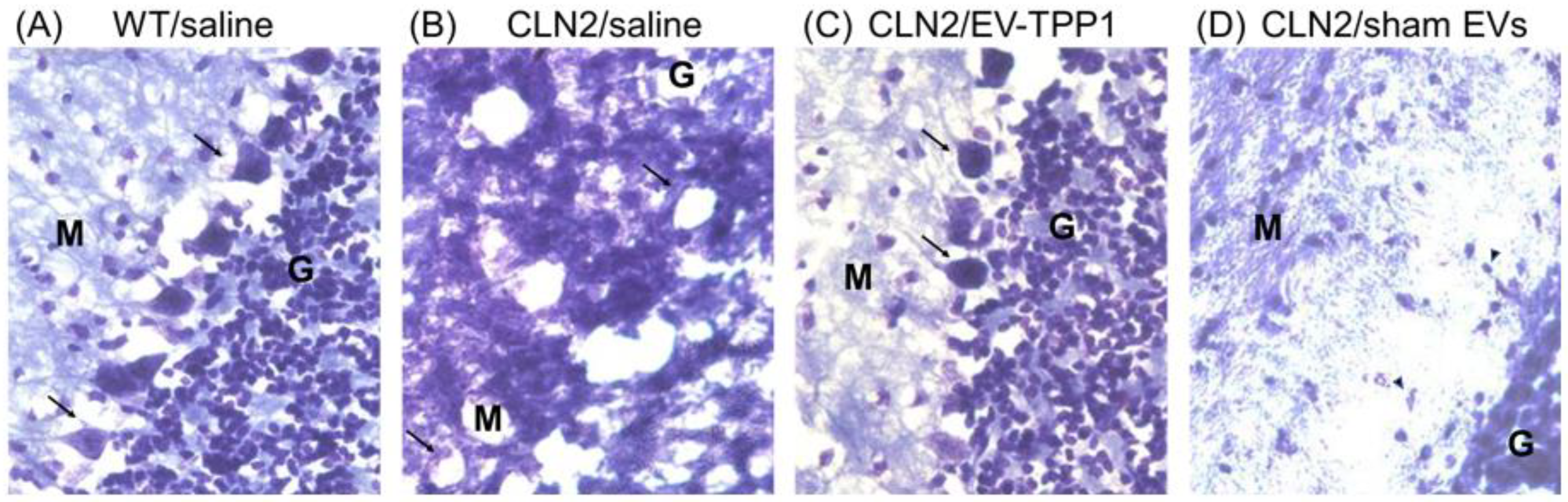 Cells 12 01497 g004 Cells 12 01497 g004