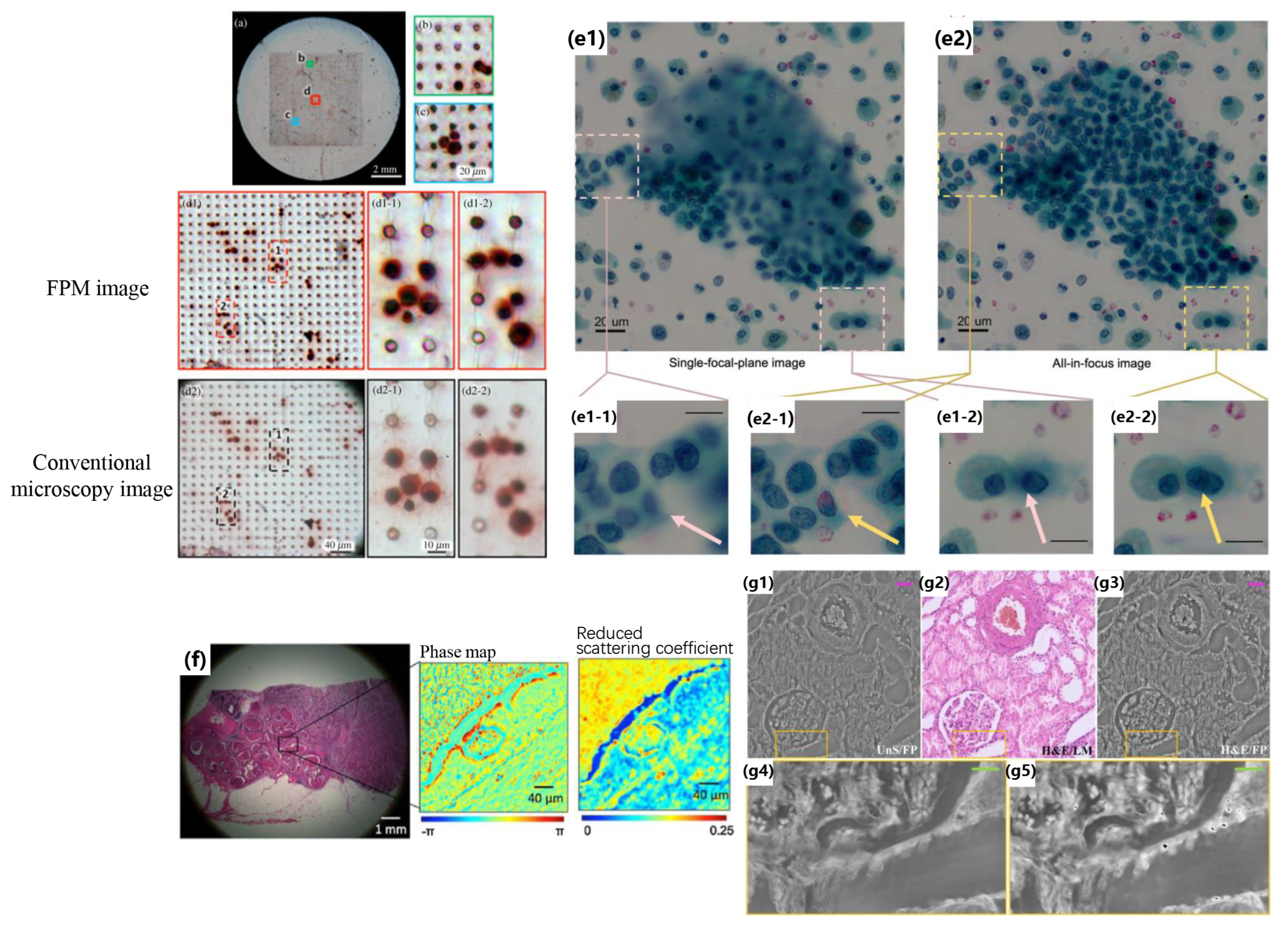 Fourier Ptychographic Microscopy 10 Years on: A Review | MDPI