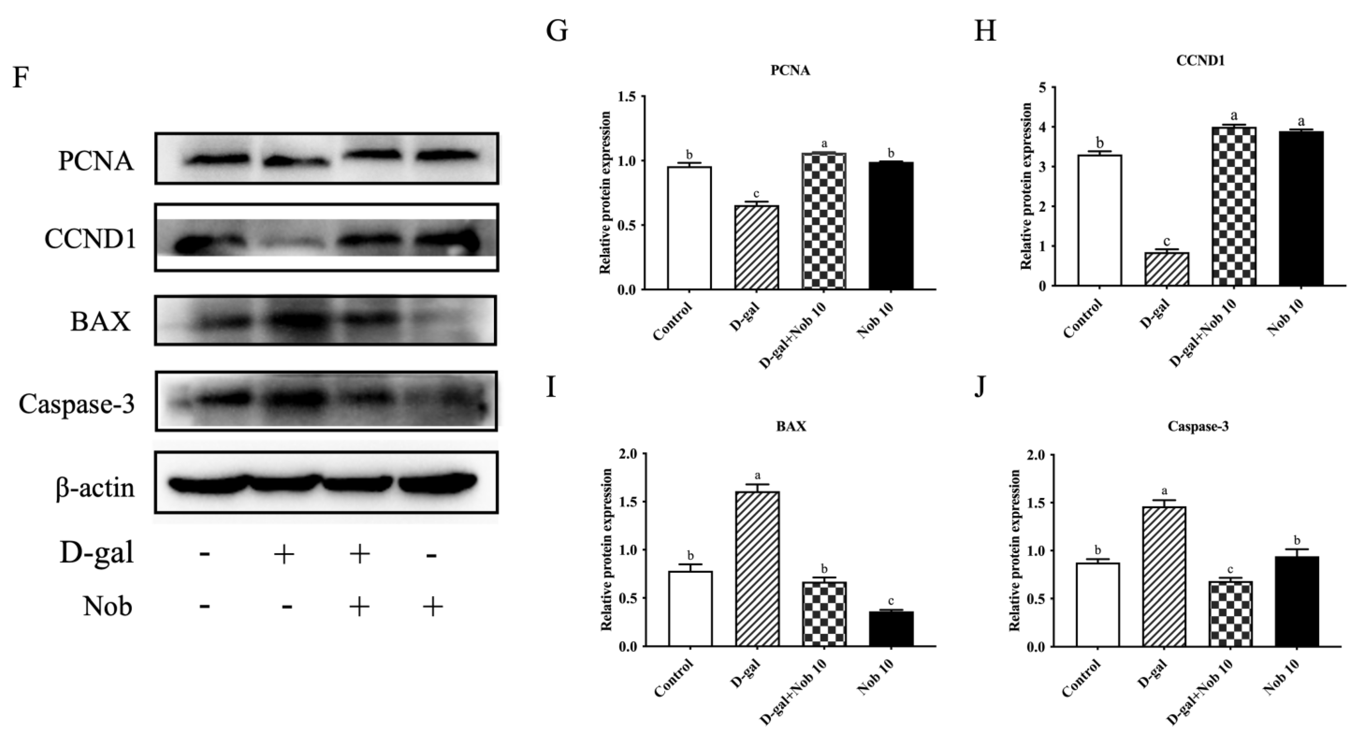 Cells 13 00415 g004b