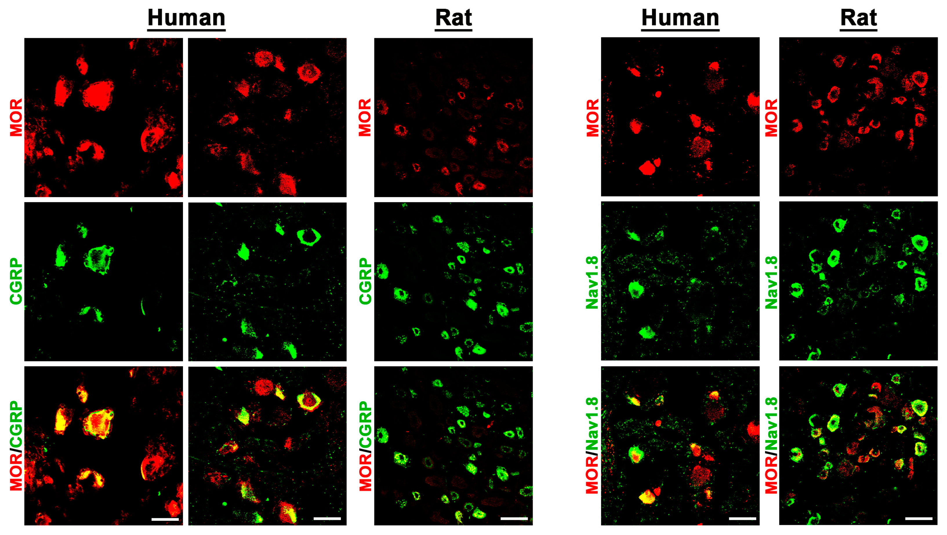 Cells 14 00694 g003