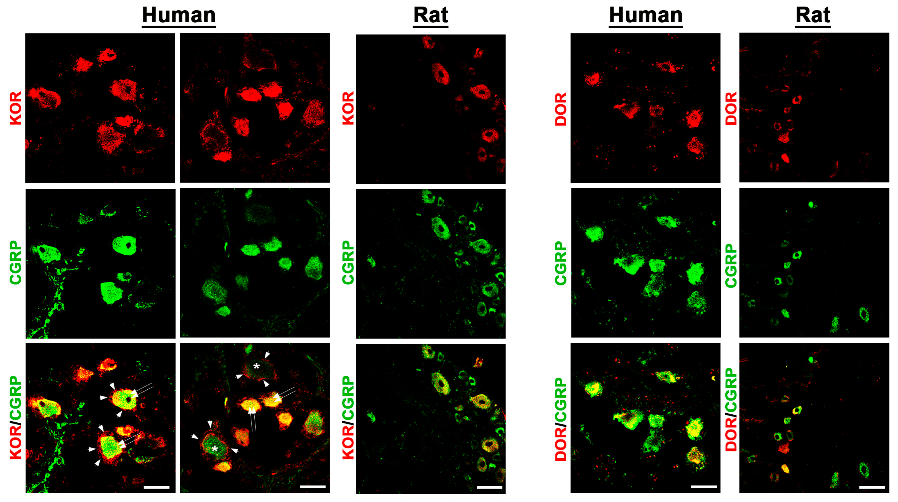 Cells 14 00694 g004