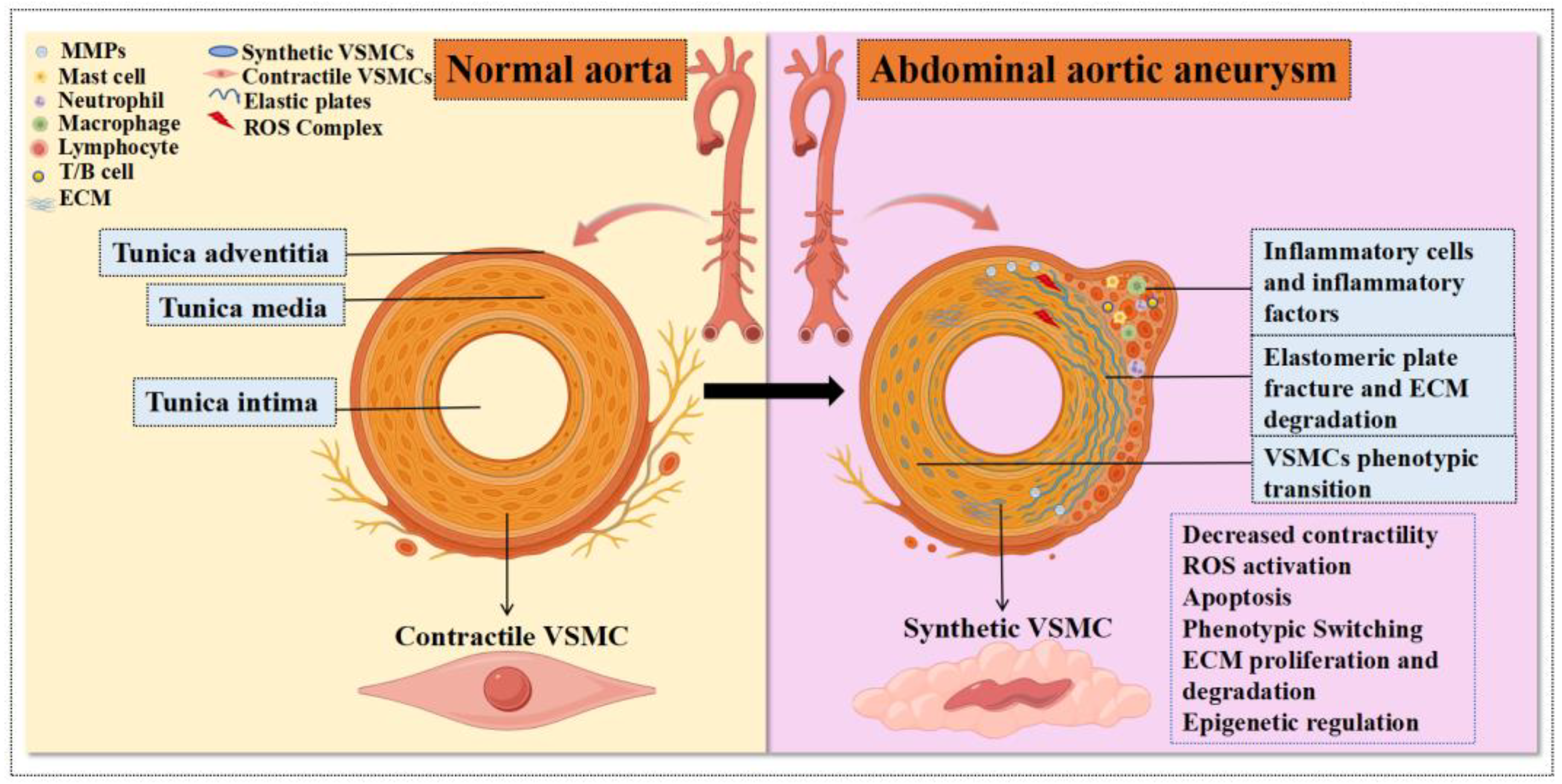 The Pathophysiological Role of Vascular Smooth Muscle Cells in ...
