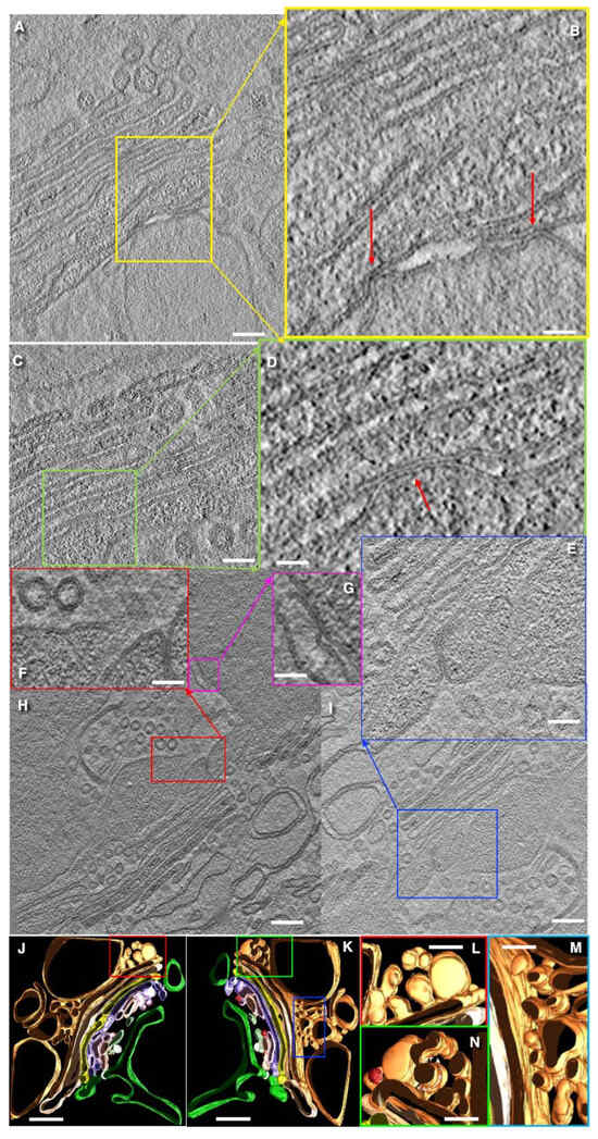 Structure of the Secretory Compartments in Goblet Cells in the Colon ...