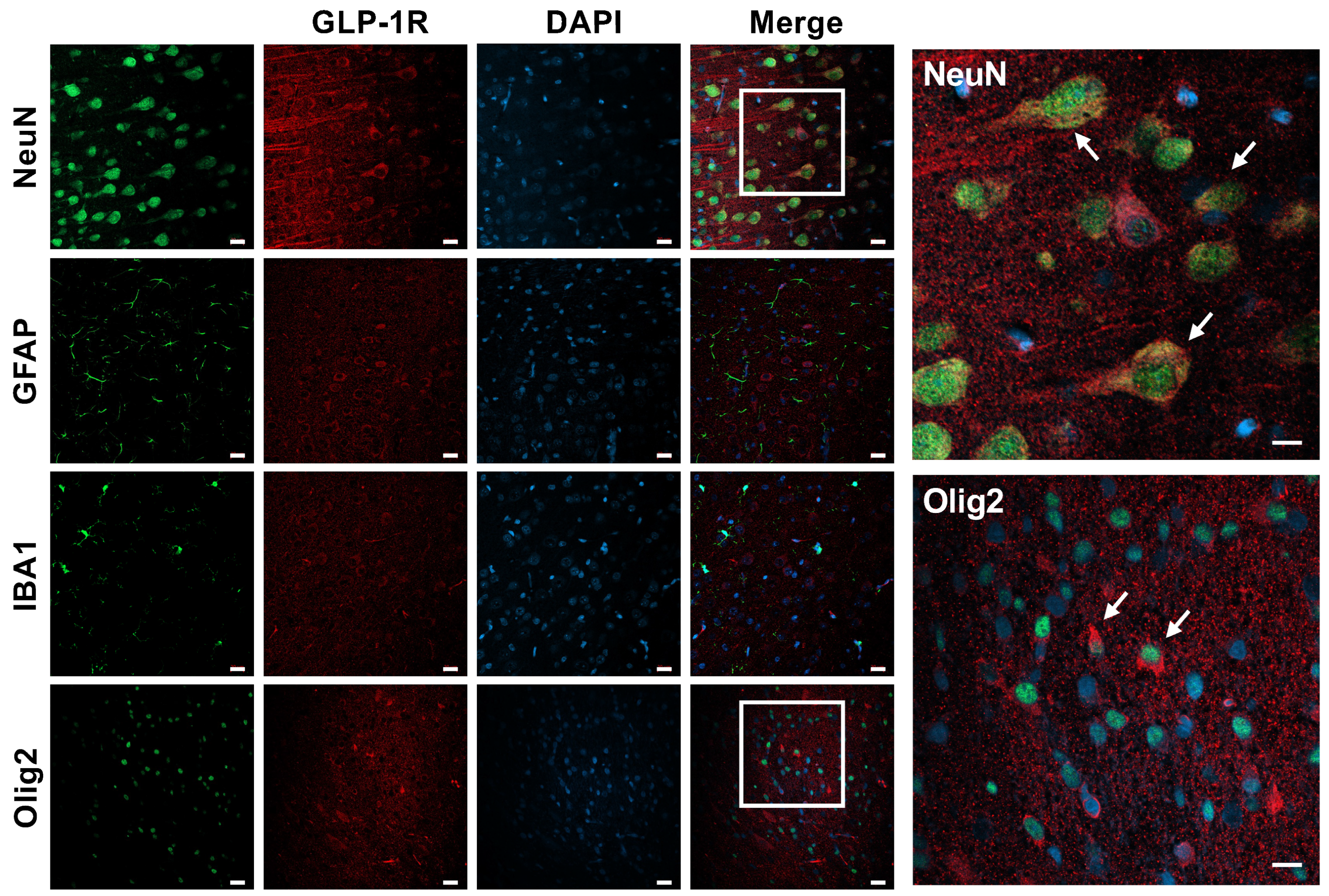 Cells 14 01715 g003 Cells 14 01715 g003