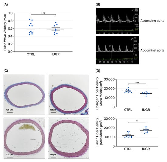 Assessment of arterial stiffness. (A) Measurement of PWV using Doppler ultrasound in 6-month-old CTRL (n = 10) and IUGR (n = 8) female rats. (B) Representative Doppler images of measurement of the time elapsed from the onset of R wave (ECG) to the aortic outflow tract (top, T1) and the abdominal aorta bifurcation (bottom, T2). (C) These pictures are representative images from collagen and elastin content in the aorta of 6-month-old CTRL and IUGR female rats (n = 10 per group) using Masson’s Trichrome and Verhoeff’s Van Gieson Elastic Lamina staining, respectively. Scale bar = 100 μm. (D) Quantification of collagen and elastin fibers density. ** p < 0.01; *** p < 0.001; ns: not significant.
