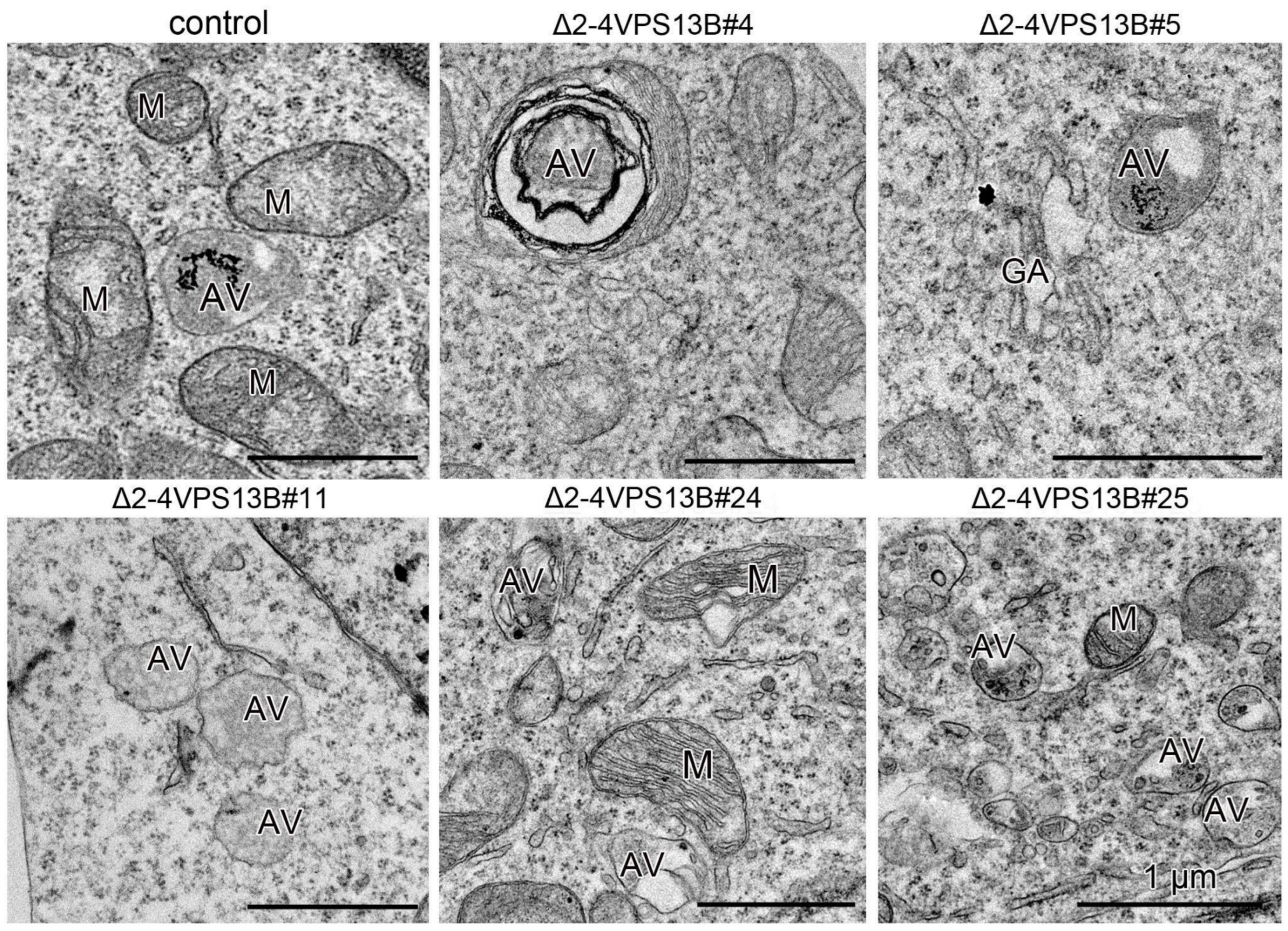Cells 15 01535 g008 Cells 15 01535 g008