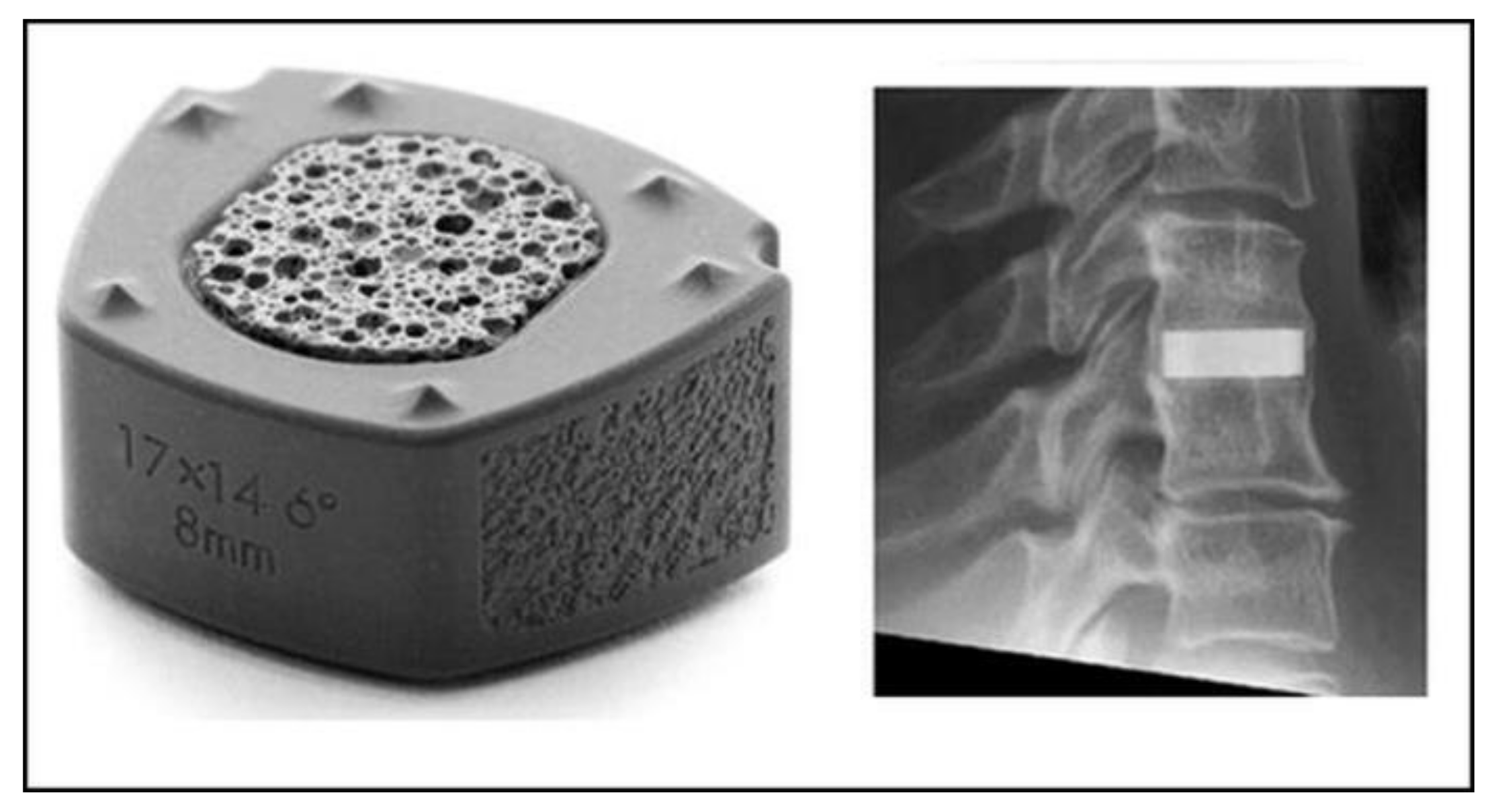 Ceramics 04 00016 g004