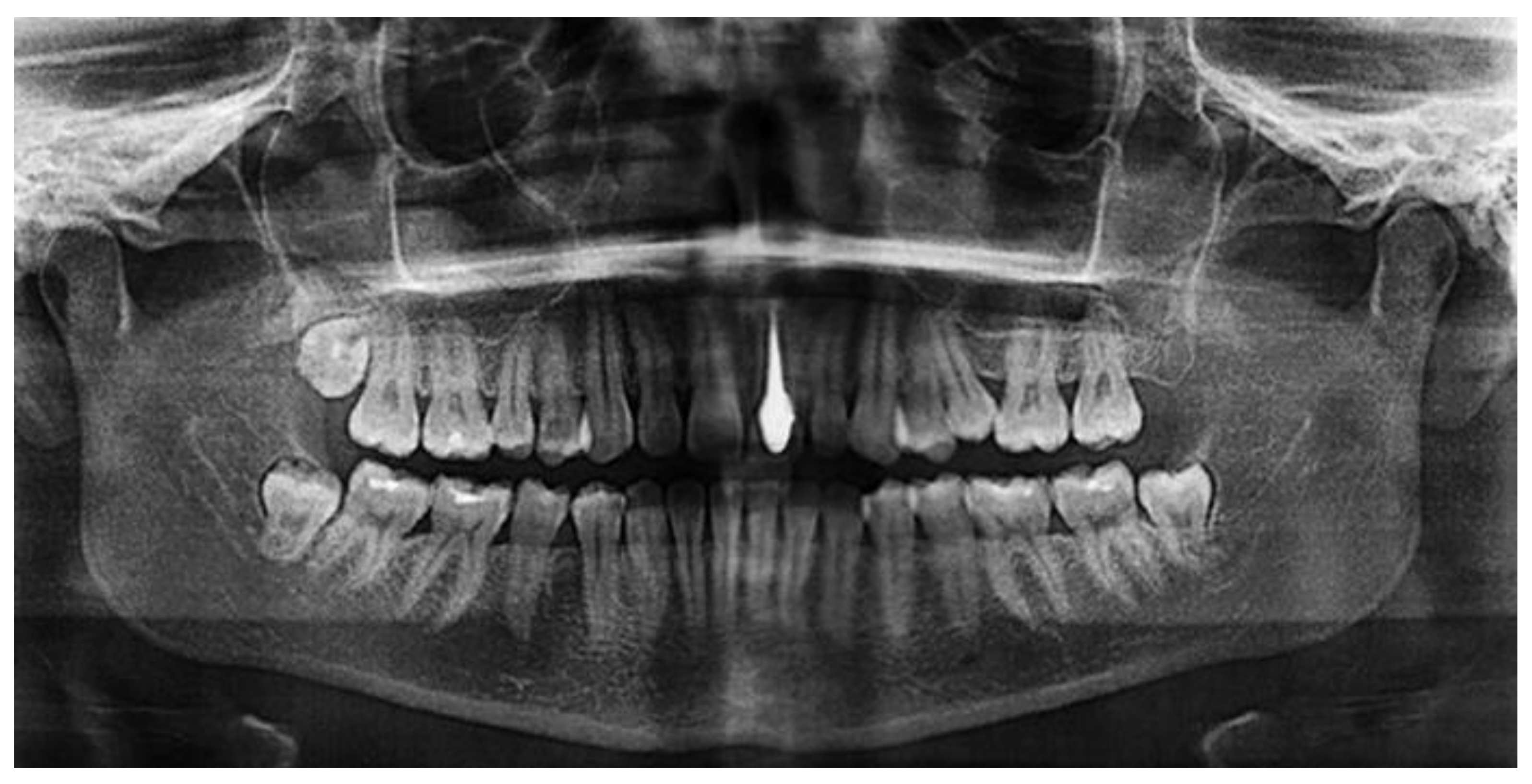 Ceramics 04 00016 g006