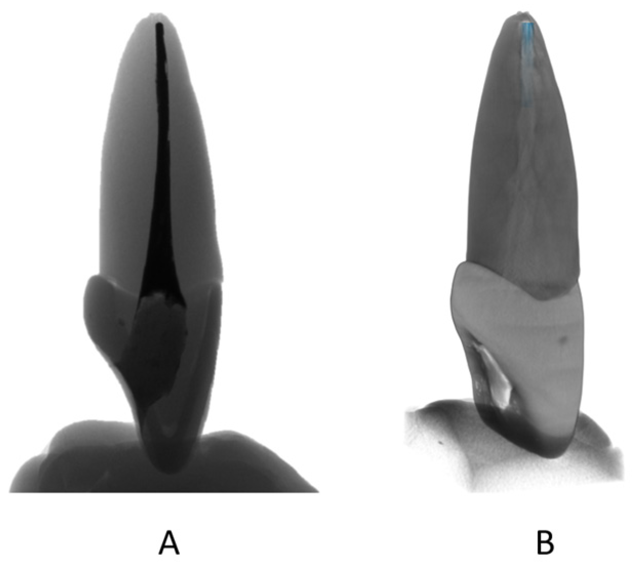 Ceramics 06 00137 g001