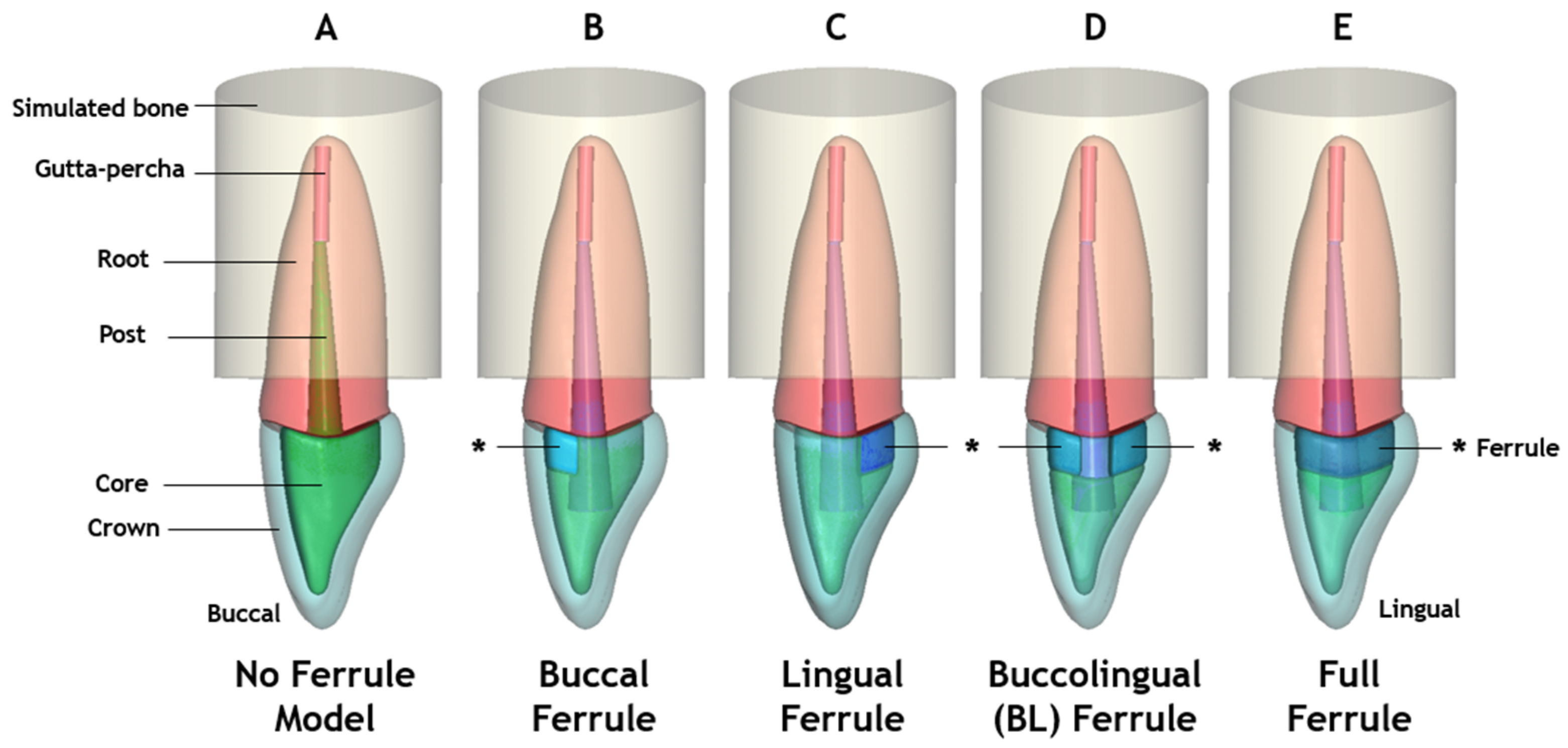 Ceramics 06 00137 g002