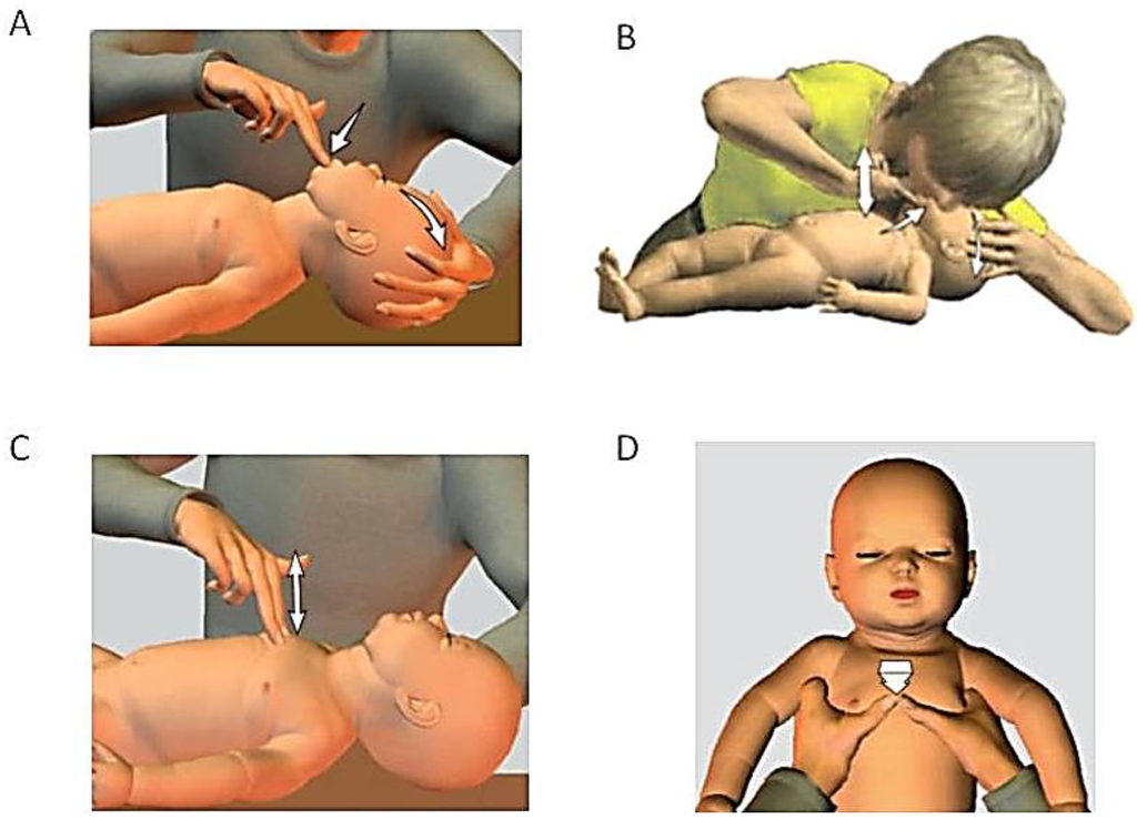 Children 01 00441 g002 1024