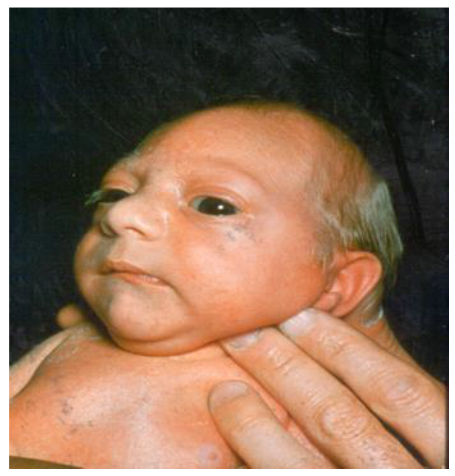 Children 04 00047 g001