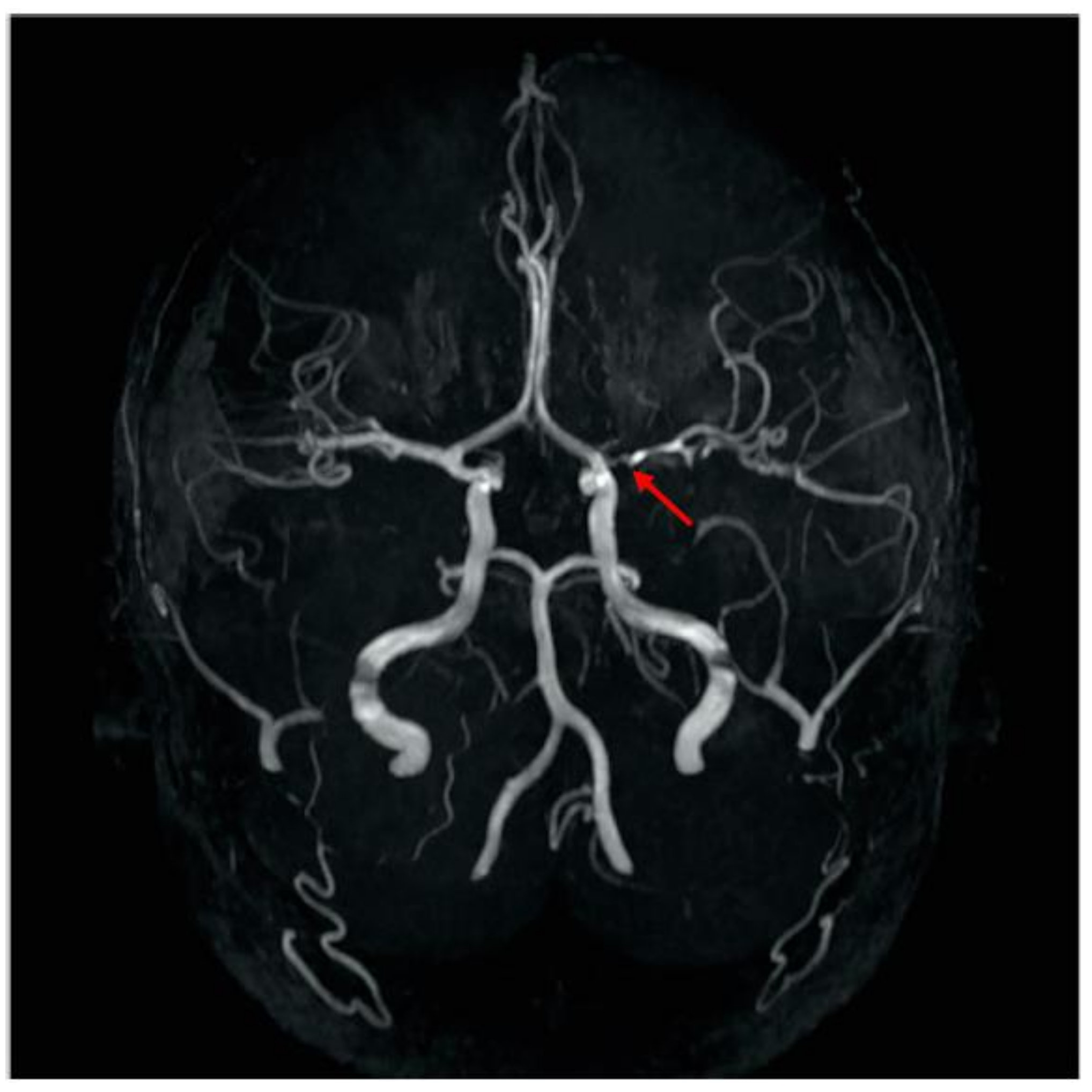 Children 04 00064 g003