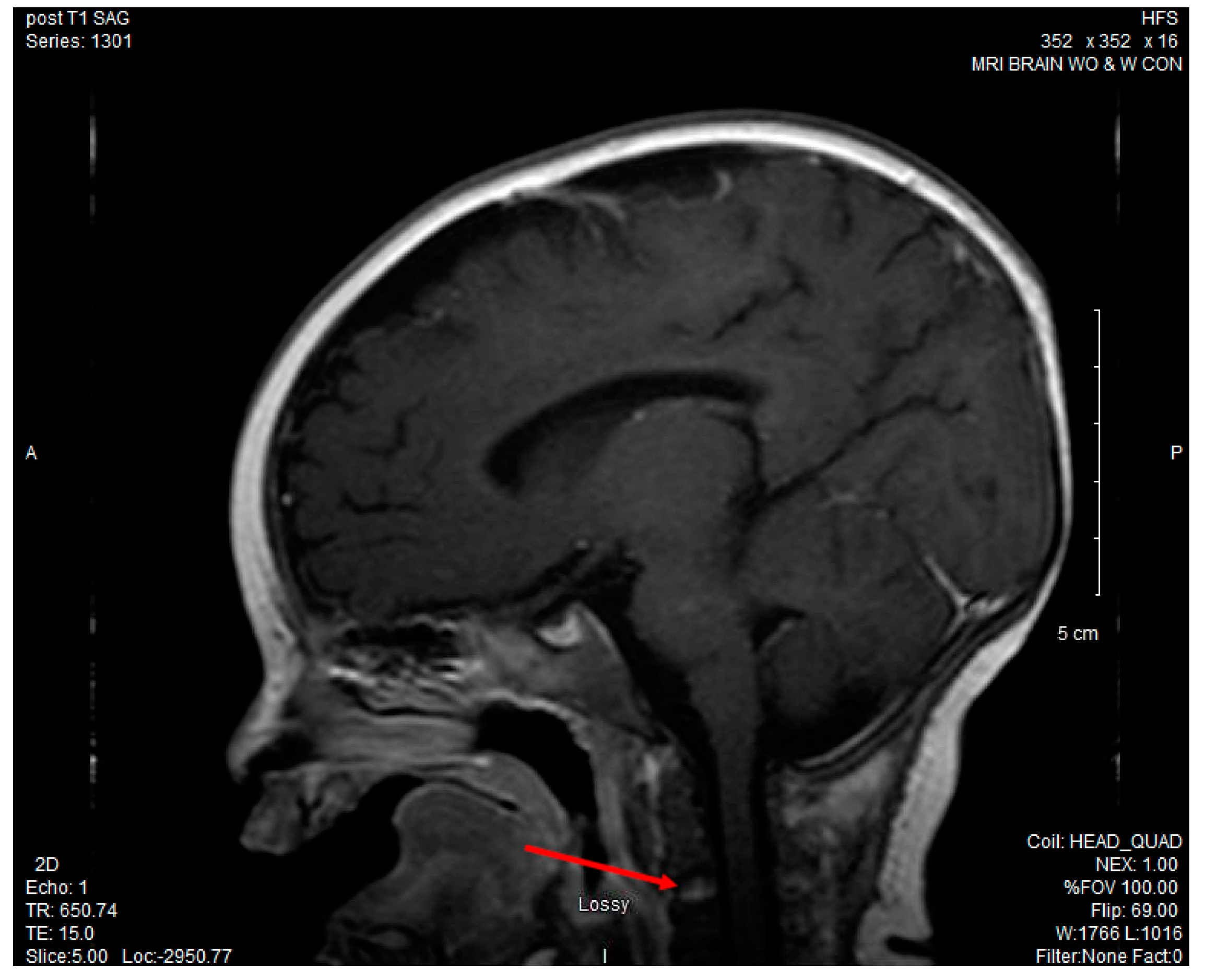 Children 04 00087 g001