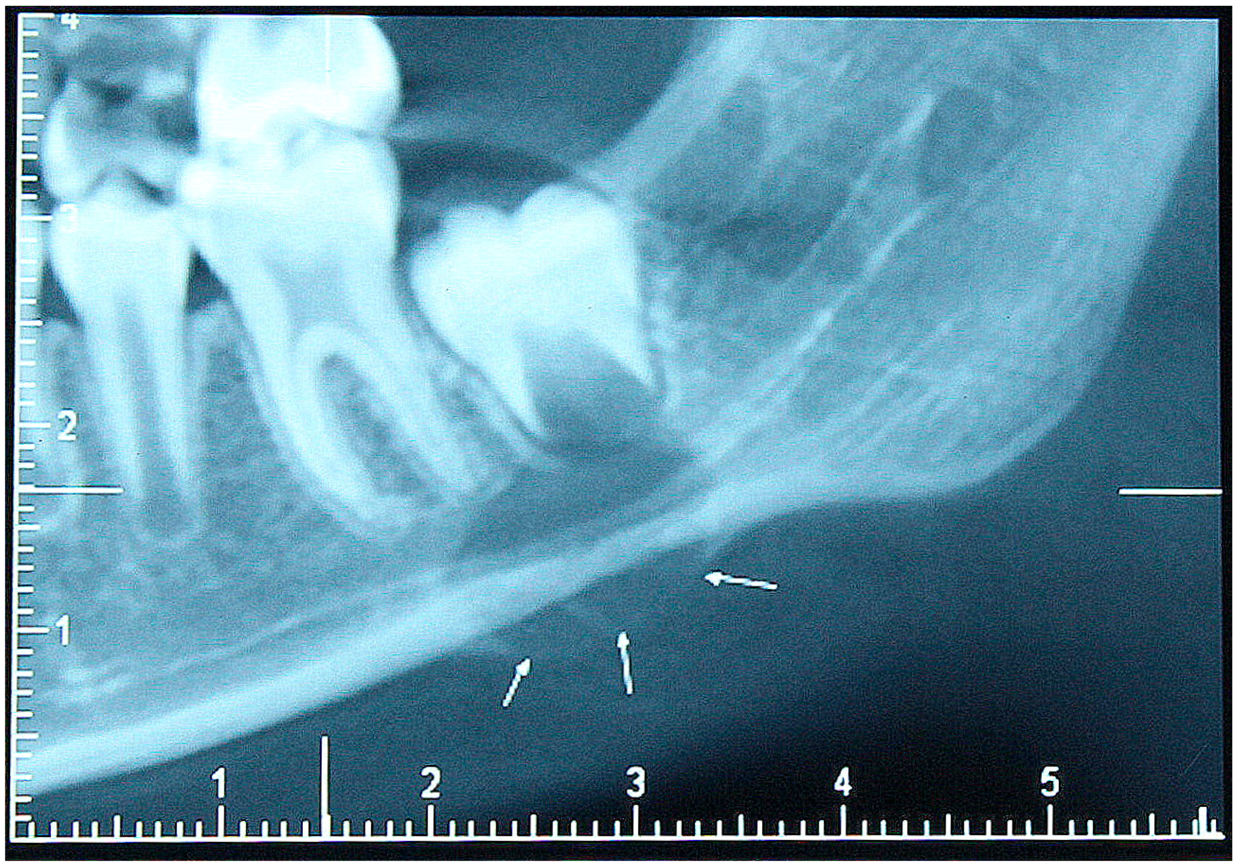 Children 04 00091 g001