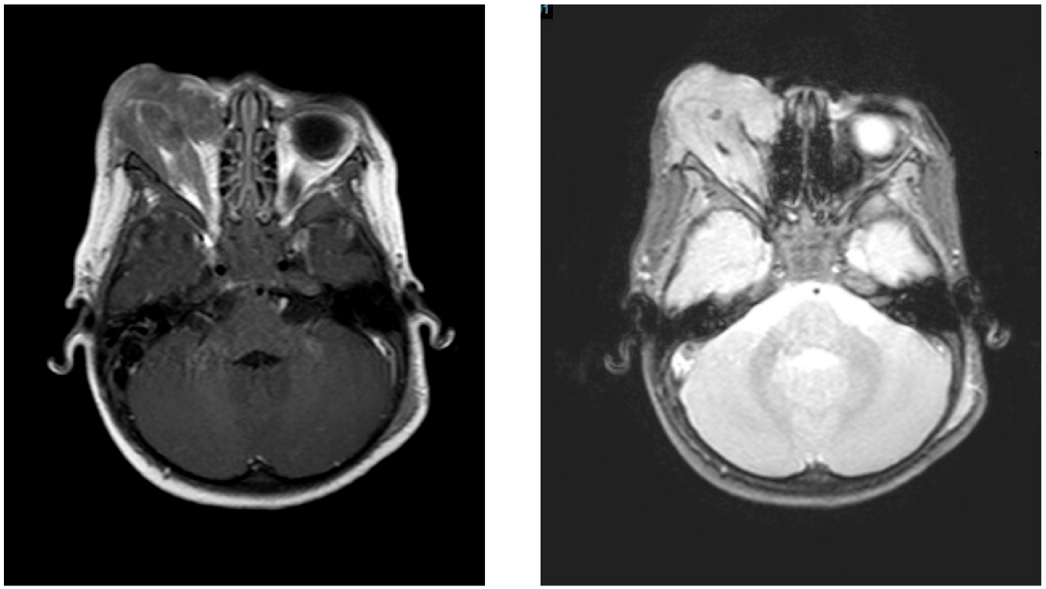 Children 04 00113 g001