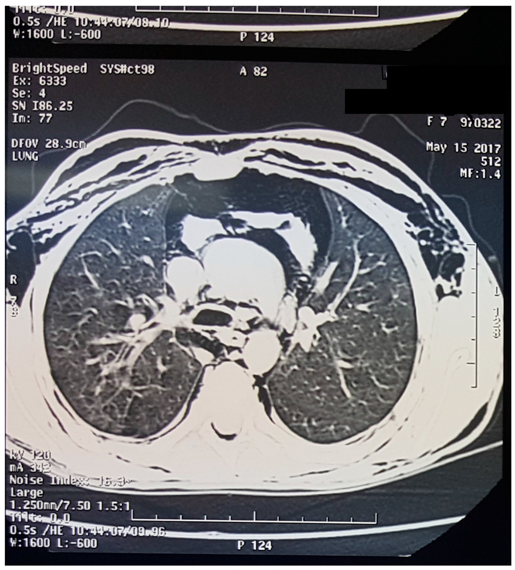 Children 05 00022 g002