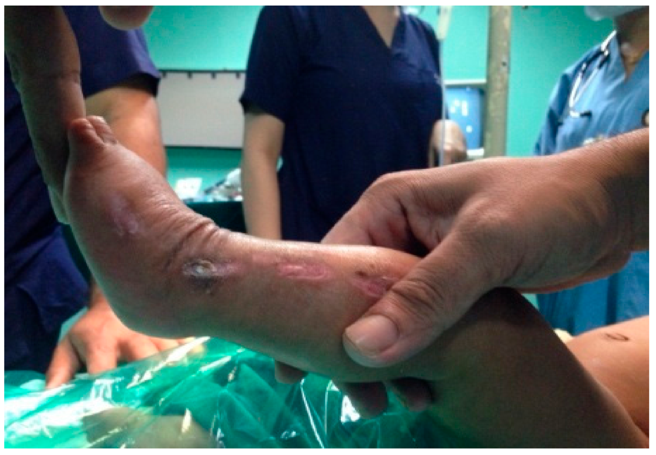 Children 05 00049 g002