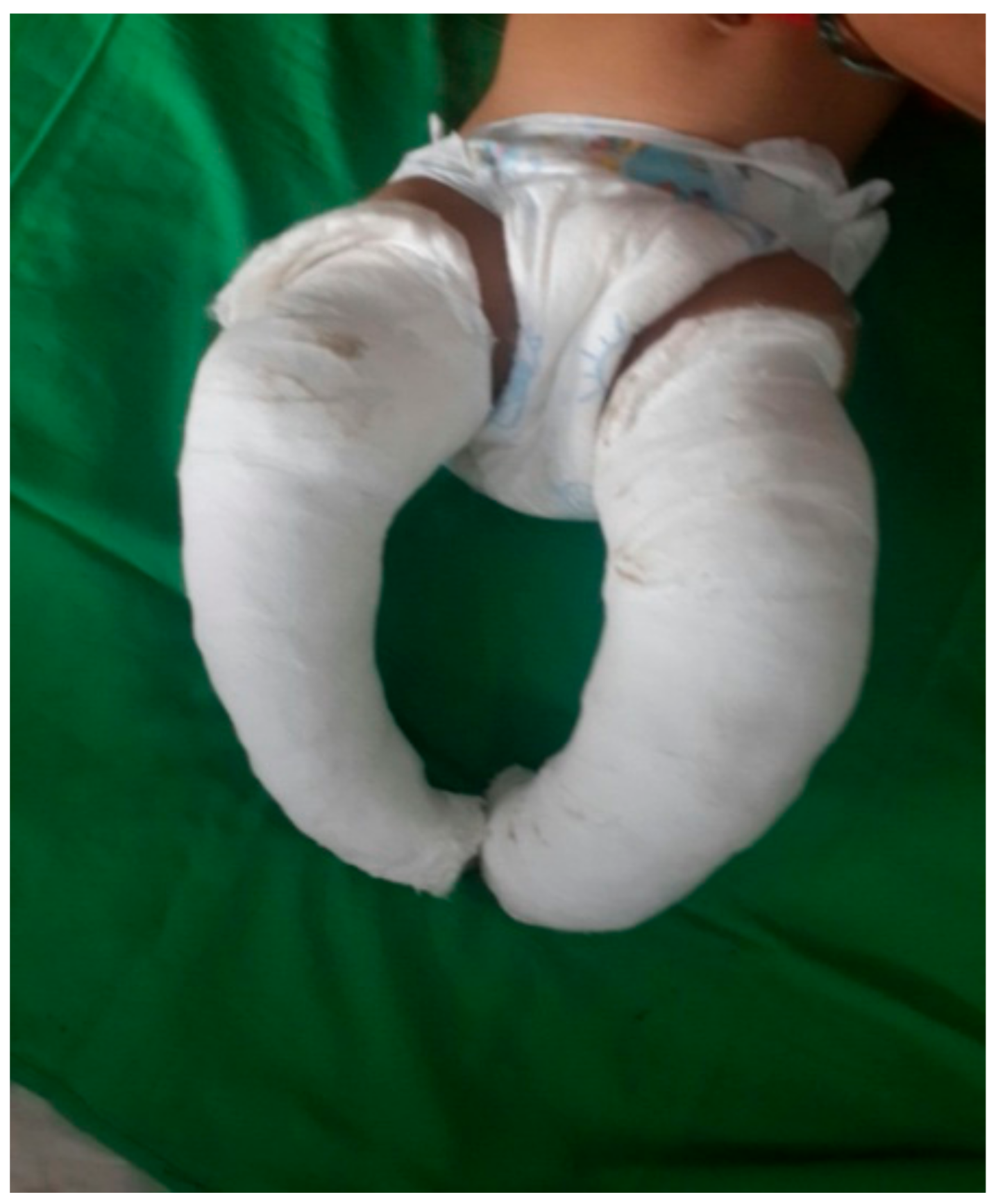 Children 05 00049 g003