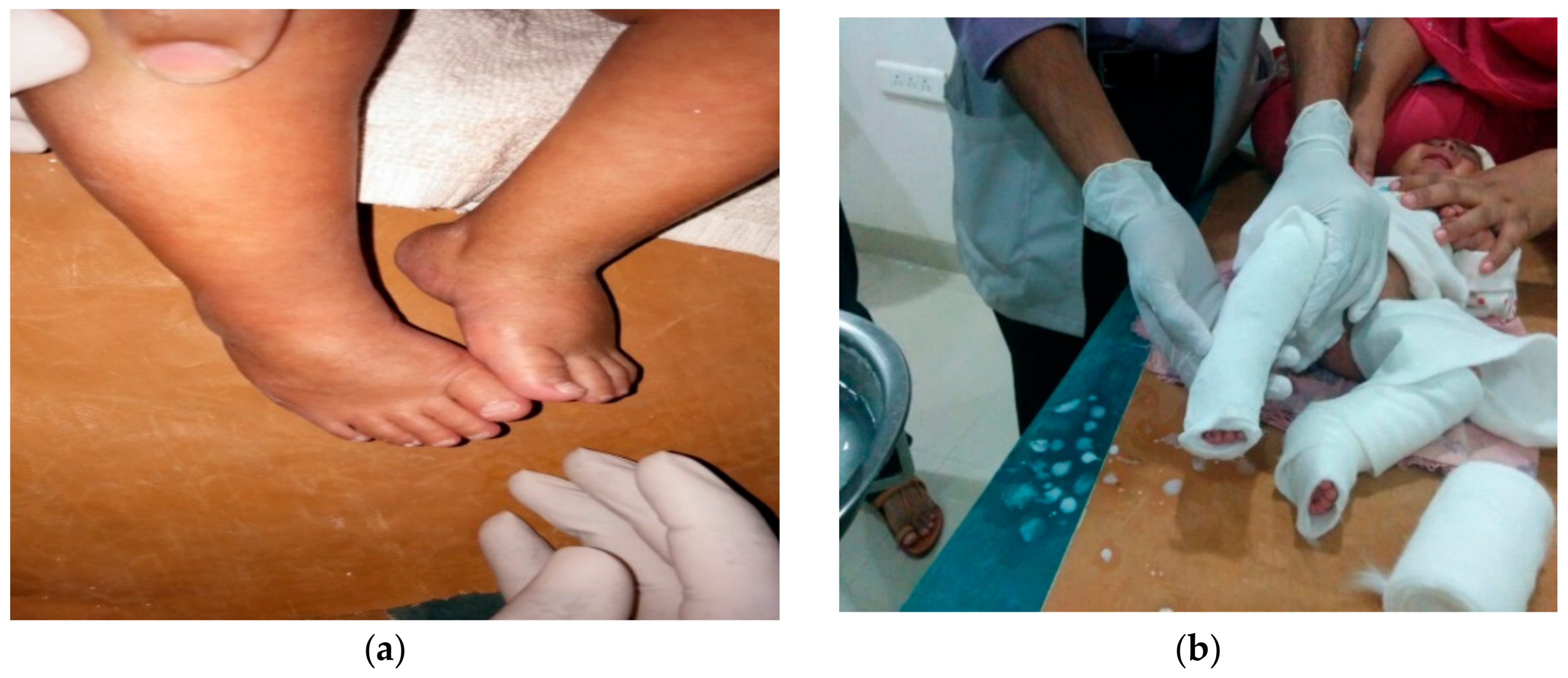 Children 05 00049 g004a